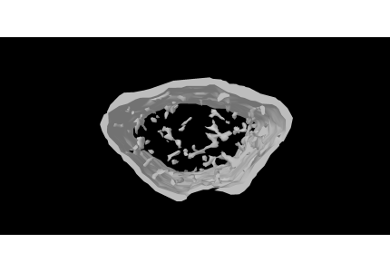 SNU Engineering–Medical Research Team Identifies, for the First Time, a New Mechanism to Enhance Osteoporosis Treatment Efficiency 