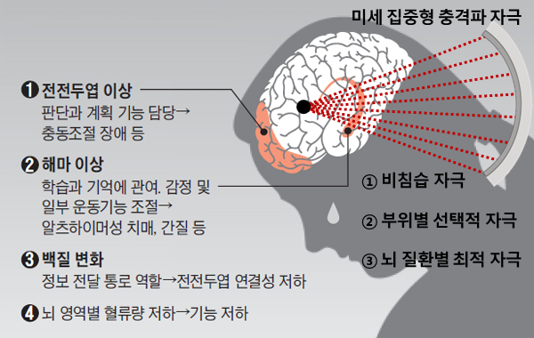 (이미지1)