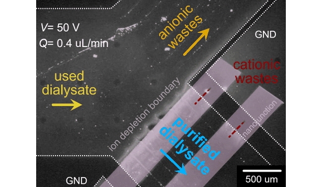 서울대 공대 전기정보공학부 김성재 교수팀, 휴대용 인공신장 개발...소형 복막투석기로 신부전증 치료 혁신 기대 