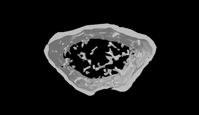 SNU Engineering–Medical Research Team Identifies, for the First Time, a New Mechanism to Enhance Osteoporosis Treatment Efficiency
