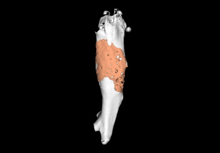 SNU Team Develops Fracture Fixation Material That Promotes Osteoporotic Fracture Healing by Controlling Magnesium Release Timing