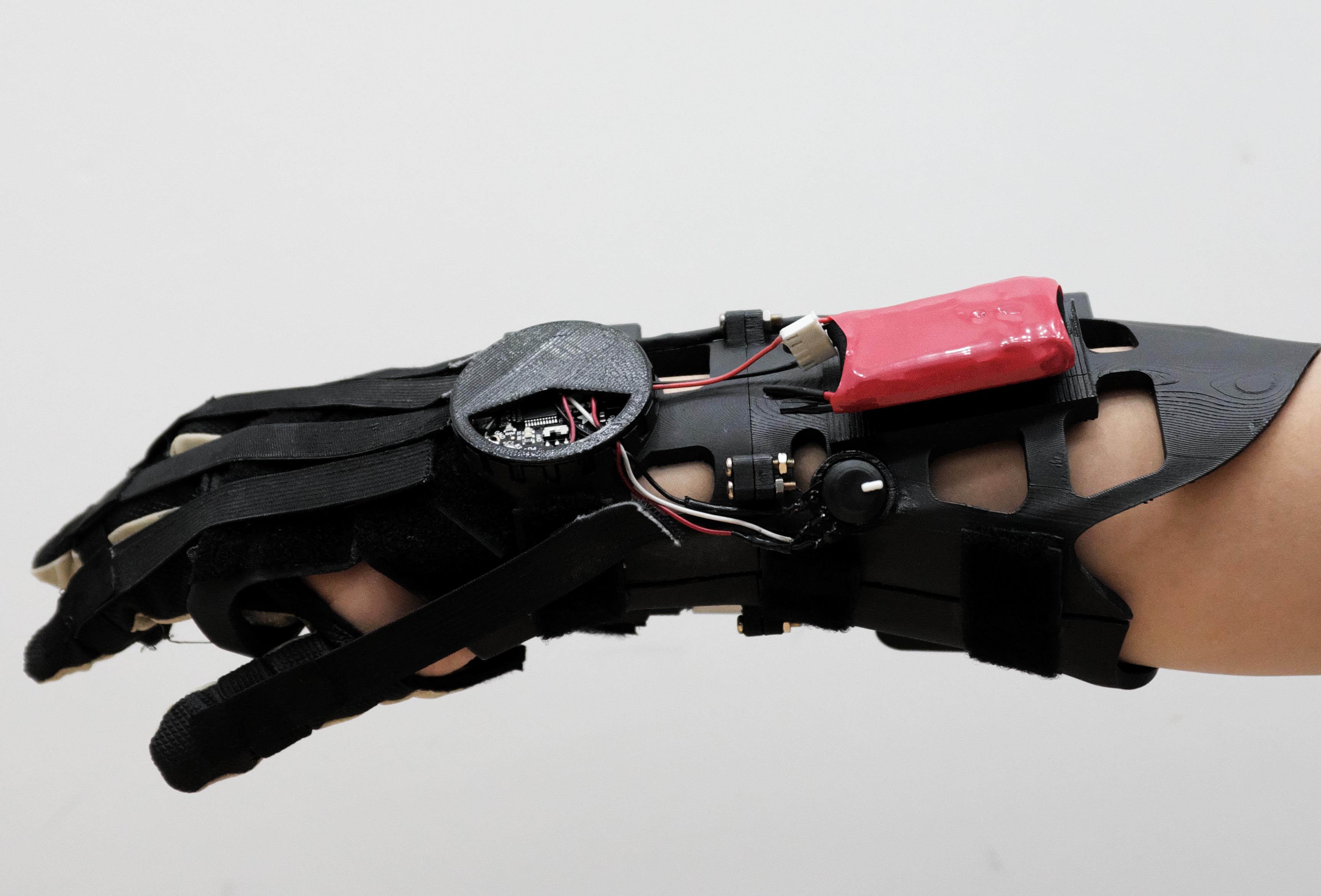 손 골절 및 힘줄 파열 재활 치료용 Dynamic Splint